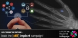 Se faire implanter une puce NFC pour piloter sa maison ?